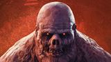 State of Decay 3 ozn�mili pr�li� skoro zo strachu, �e Undead Labs Microsoft zru�� alebo pred�